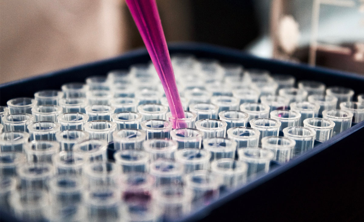 El mapa de la innovación farmaceútica