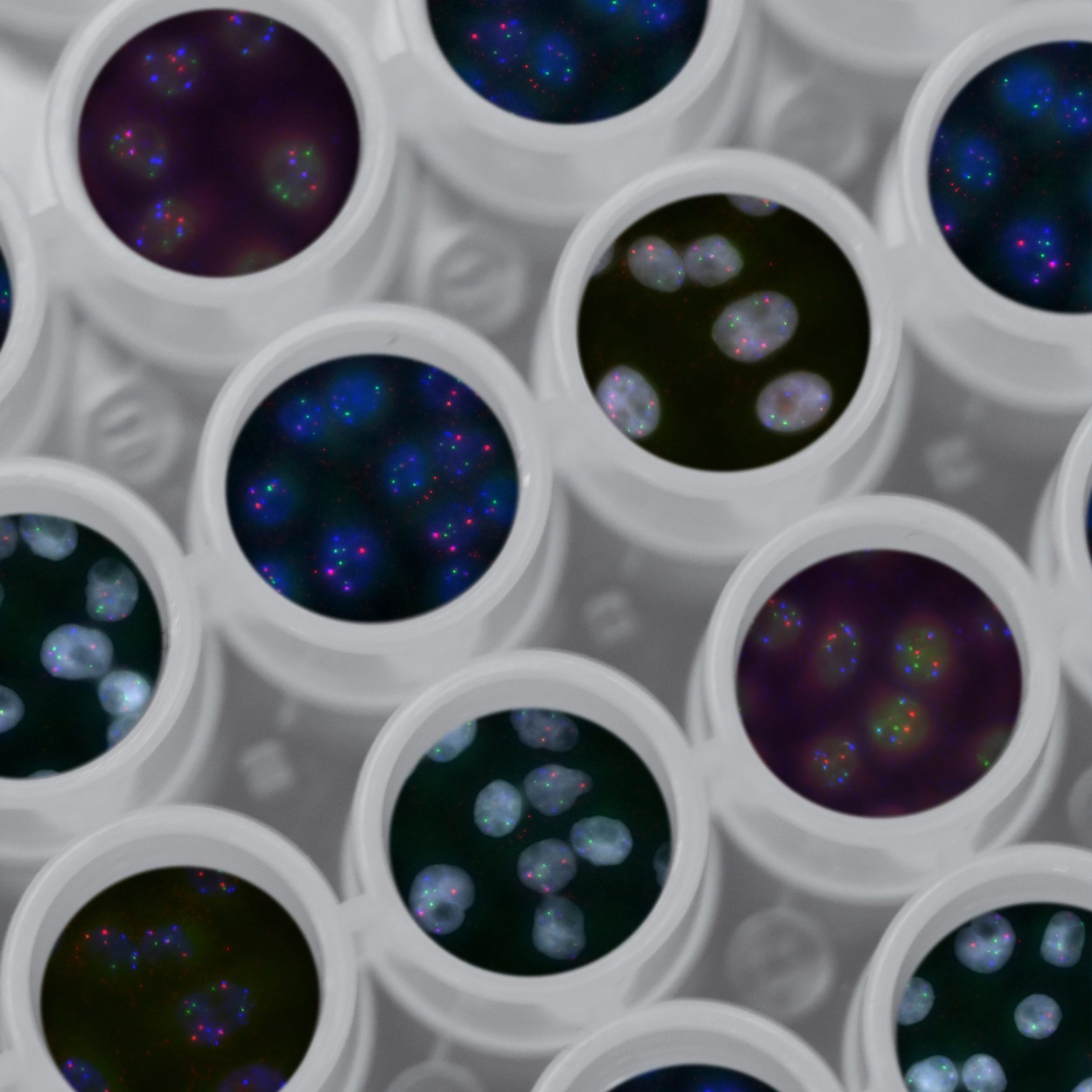 Tres mujeres brillantes que quieren transformar la neurociencia