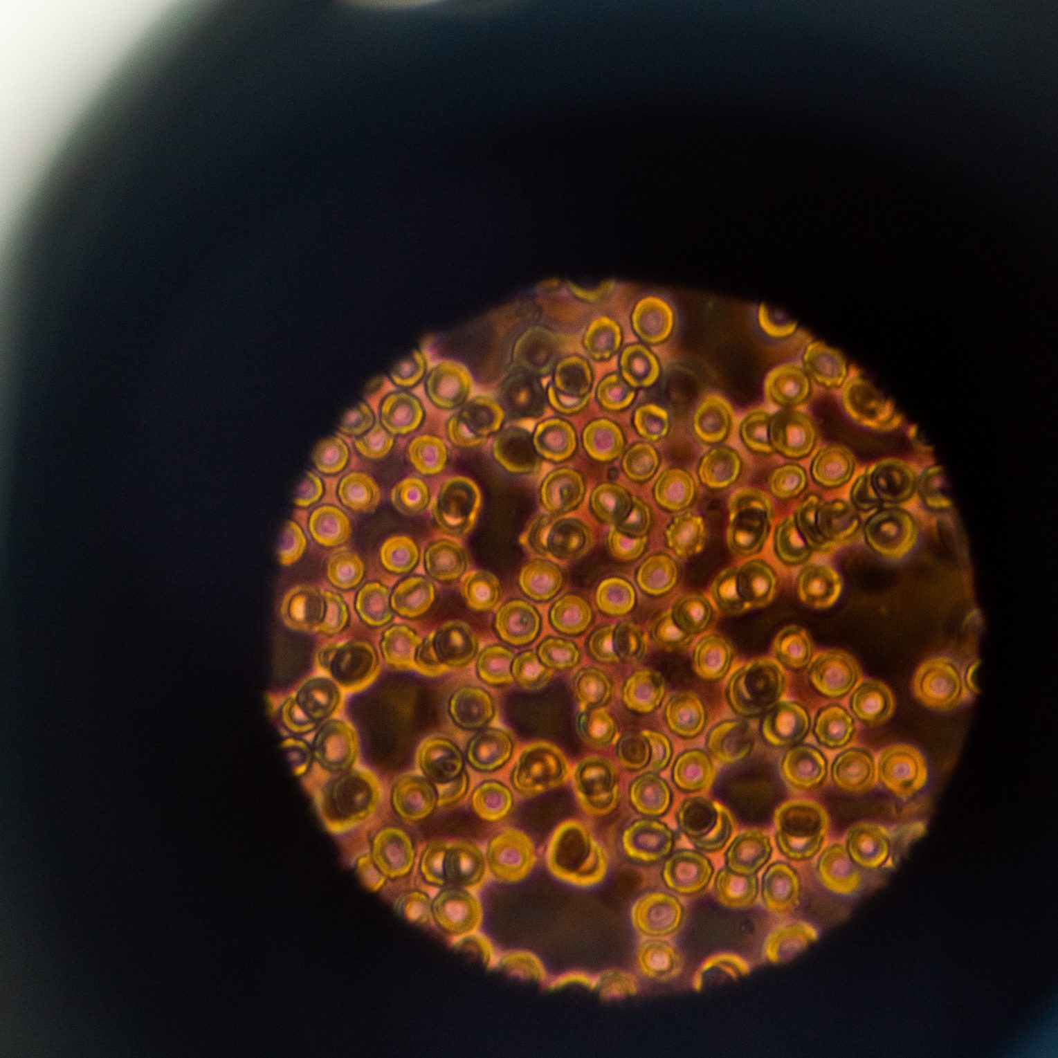 Terapias genéticas orientadas: cómo afinar la última milla de la medicina